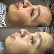 Men’s Facial